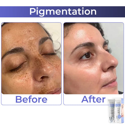 🏆 flysmus™ Advanced Collagen Complete Eye Cream ✨ Dermatologist Recommended