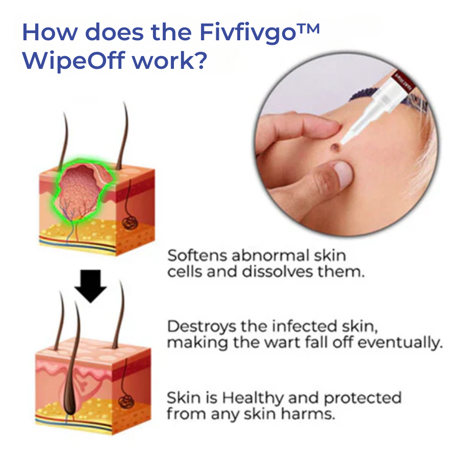 Fivfivgo™ WipeOff Tags & Moles Remover