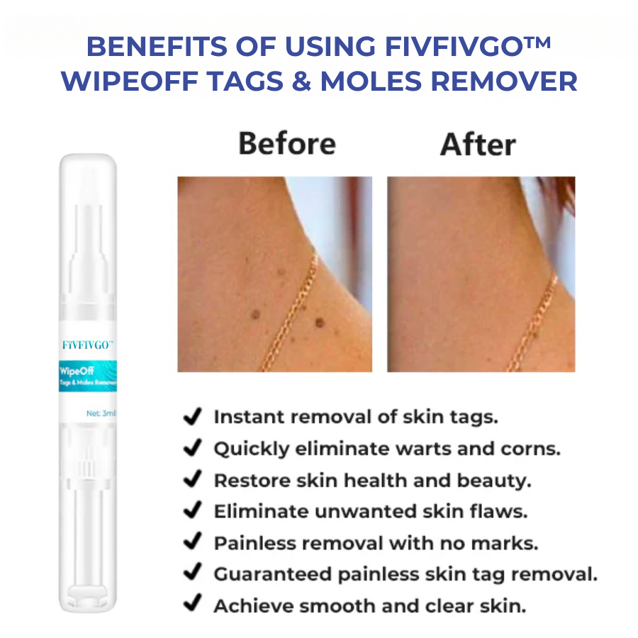 Fivfivgo™ WipeOff Tags & Moles Remover