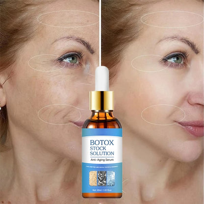 🔥 LAST DAY SALE-49%OFF 🔥 -  Botox Face Serum