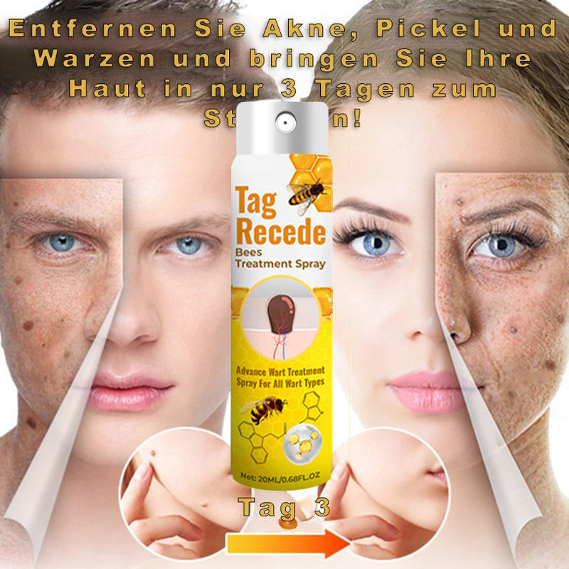 ✅ Official store: 🔥🐝AQA™TagRecede Bee Spray ✨👨‍⚕️ Approved by the American Association of Dermatology (AAOS) (Removal of skin tags, warts, nevus, fibromatous nevus, lipofluid keratosis, filamentous skin tags, fibroepithelial polyps, or stem skin tags)